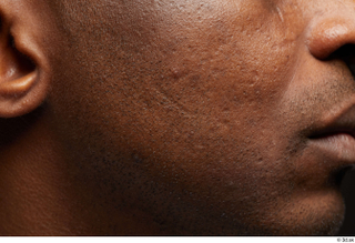 HD Face Skin Najeem Bonner cheek face lips mouth scar…